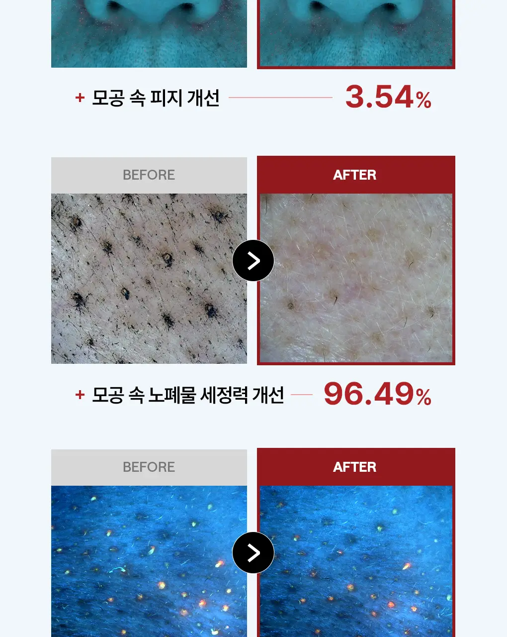 [76관왕 No.1] 메디힐 더마 패드 100매 7종 피부 고민별 골라담기 상세페이지 37